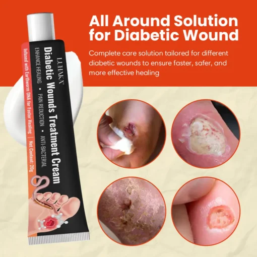 Luhaka™ Diabetic Wounds Treatment Cream