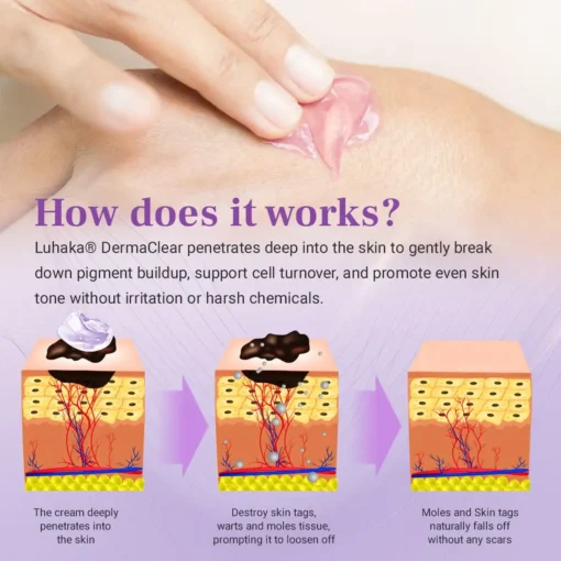 Luhaka® DermaClear Mole and Dark Spot Removal Bio-Gel