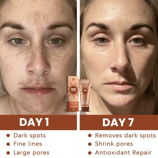 Luhaka® Herbal Spots Feel-off Facial Mask