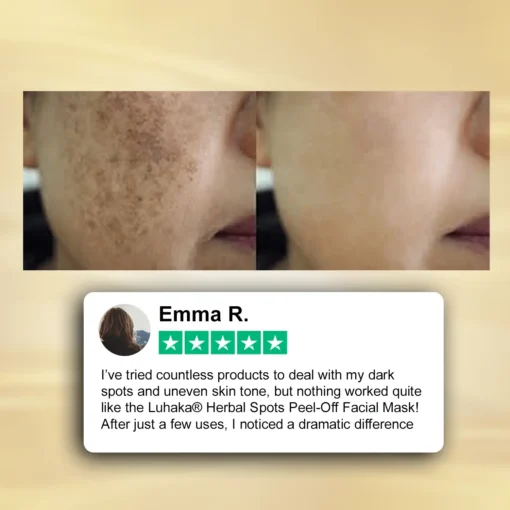 Luhaka® Herbal Spots Feel-off Facial Mask