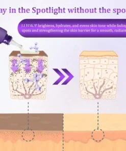 Luhaka® LumiDerma Anti-Hyperpigmentation Cream