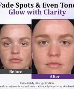 Luhaka® LumiDerma Anti-Hyperpigmentation Cream