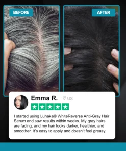 Luhaka® WhiteReverse Anti-Gray Hair Serum