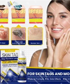 LUHAKA® SKIN TAG CRYO TREATMENT SPRAY
