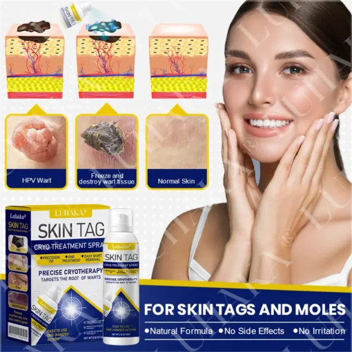 LUHAKA® SKIN TAG CRYO TREATMENT SPRAY