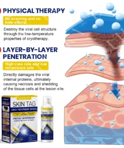 LUHAKA® SKIN TAG CRYO TREATMENT SPRAY