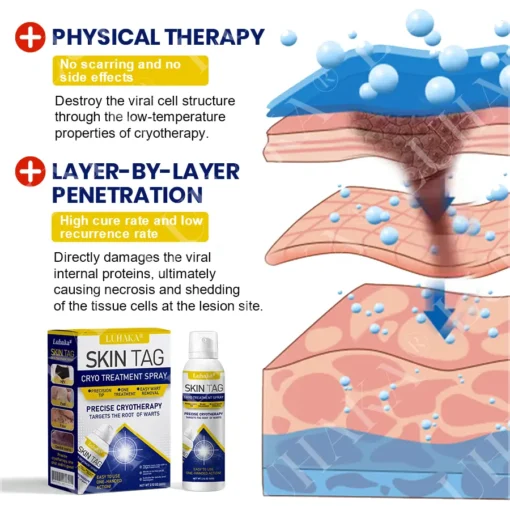 LUHAKA® SKIN TAG CRYO TREATMENT SPRAY