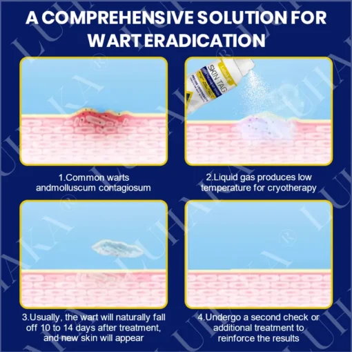LUHAKA® SKIN TAG CRYO TREATMENT SPRAY