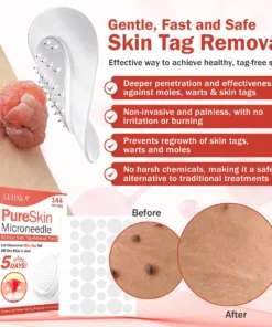 Luhaka® PureSkin Microneedle Botanic Skin Tag Removal Patch