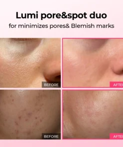 LUHAKA® Pore & Spot Care Duo