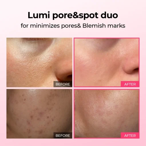 LUHAKA® Pore & Spot Care Duo