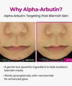 LUHAKA® Pore & Spot Care Duo