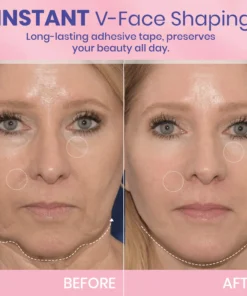 LUHAKA® V-Face Lifting Invisible Adhesive Tape