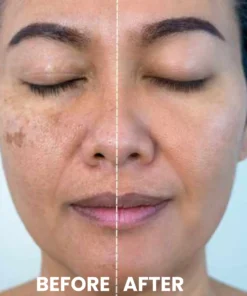 Luhaka® Ricerase Dual-Action Renewal Cream