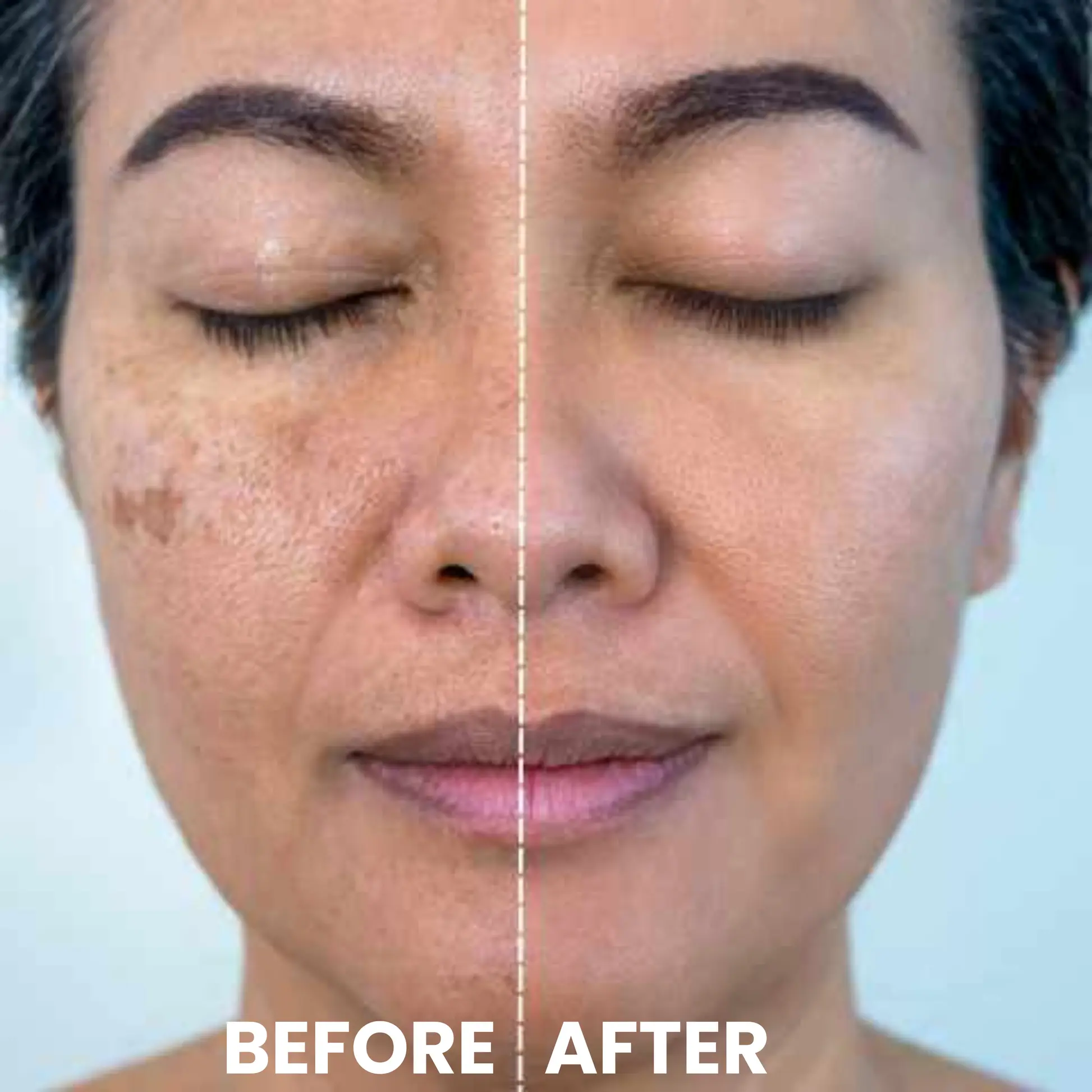 Luhaka® Ricerase Dual-Action Renewal Cream