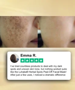 Luhaka® Herbal Spots Feel-off Facial MaskUltra02