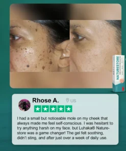 Luhaka® Naturestore Mole and Wart Removal GelUltra01