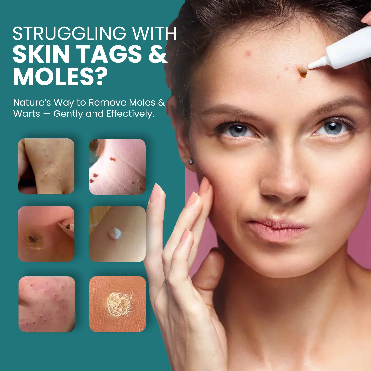 Luhaka® Naturestore Mole and Wart Removal GelUltra01