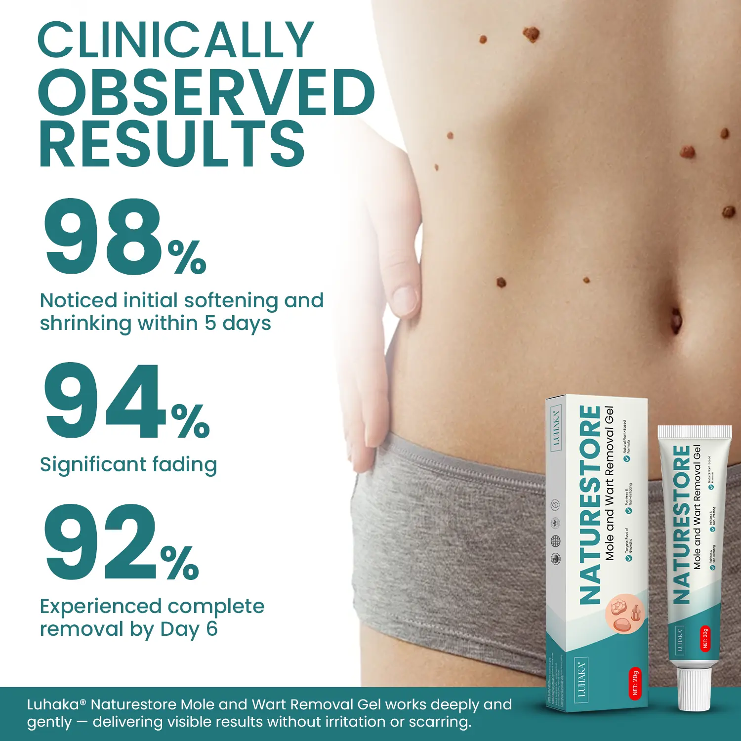 Luhaka® Naturestore Mole and Wart Removal GelUltra01