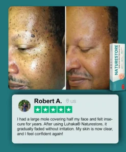 Luhaka® Naturestore Mole and Wart Removal GelUltra01