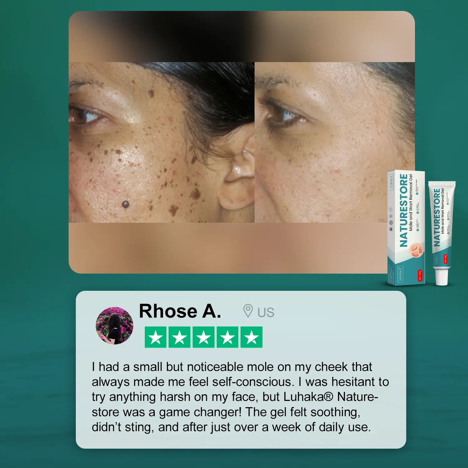 Luhaka® Naturestore Mole and Wart Removal GelUltra03