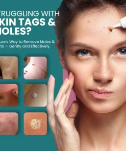 Luhaka® Naturestore Mole and Wart Removal GelUltra03