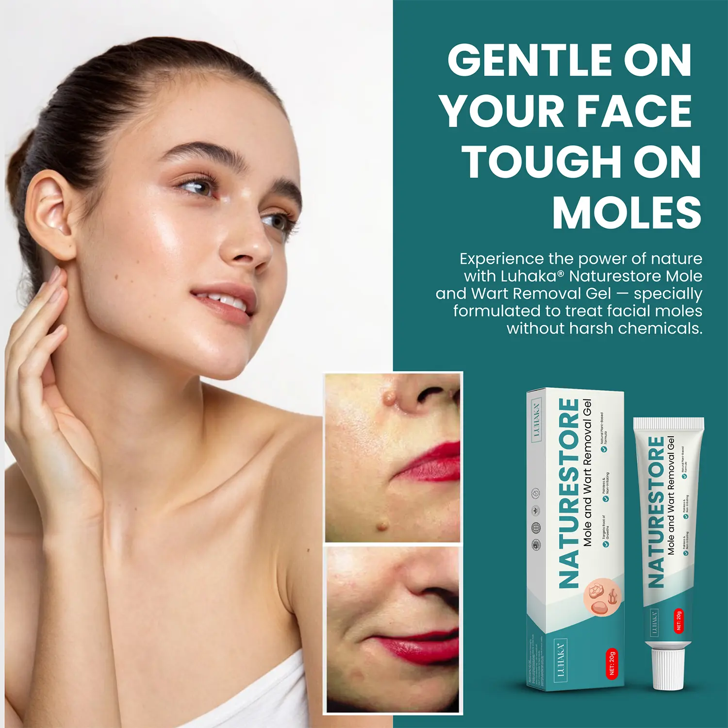 Luhaka® Naturestore Mole and Wart Removal GelUltra03