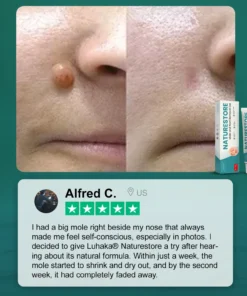 Luhaka® Naturestore Mole and Wart Removal GelUltra04