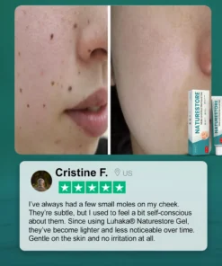 Luhaka® Naturestore Mole and Wart Removal GelUltra04