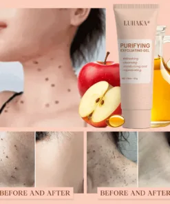 Luhaka® Purifying Exfoliating Gel ACE 9 for Acanthosis Nigricans, Exfoliation, Dark Spots, Skin Tags, and Eczema