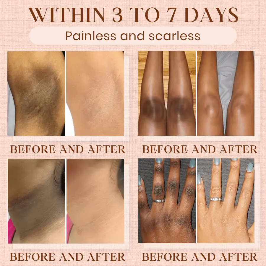 Luhaka® Purifying Exfoliating Gel ACE 9 for Acanthosis Nigricans, Exfoliation, Dark Spots, Skin Tags, and Eczema