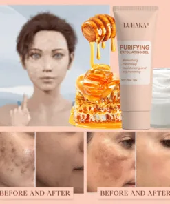 Luhaka® Purifying Exfoliating Gel ACE 9 for Acanthosis Nigricans, Exfoliation, Dark Spots, Skin Tags, and Eczema