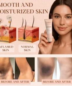 Luhaka® Purifying Exfoliating Gel ACE 9 for Acanthosis Nigricans, Exfoliation, Dark Spots, Skin Tags, and Eczema