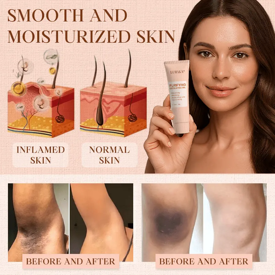 Luhaka® Purifying Exfoliating Gel ACE 9 for Acanthosis Nigricans, Exfoliation, Dark Spots, Skin Tags, and Eczema