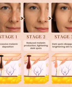 Luhaka® Purifying Exfoliating Gel ACE 9 for Acanthosis Nigricans, Exfoliation, Dark Spots, Skin Tags, and Eczema