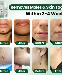 Luhaka® Reedle Shot 100 Tag Spot Target Advanced Serum ACE