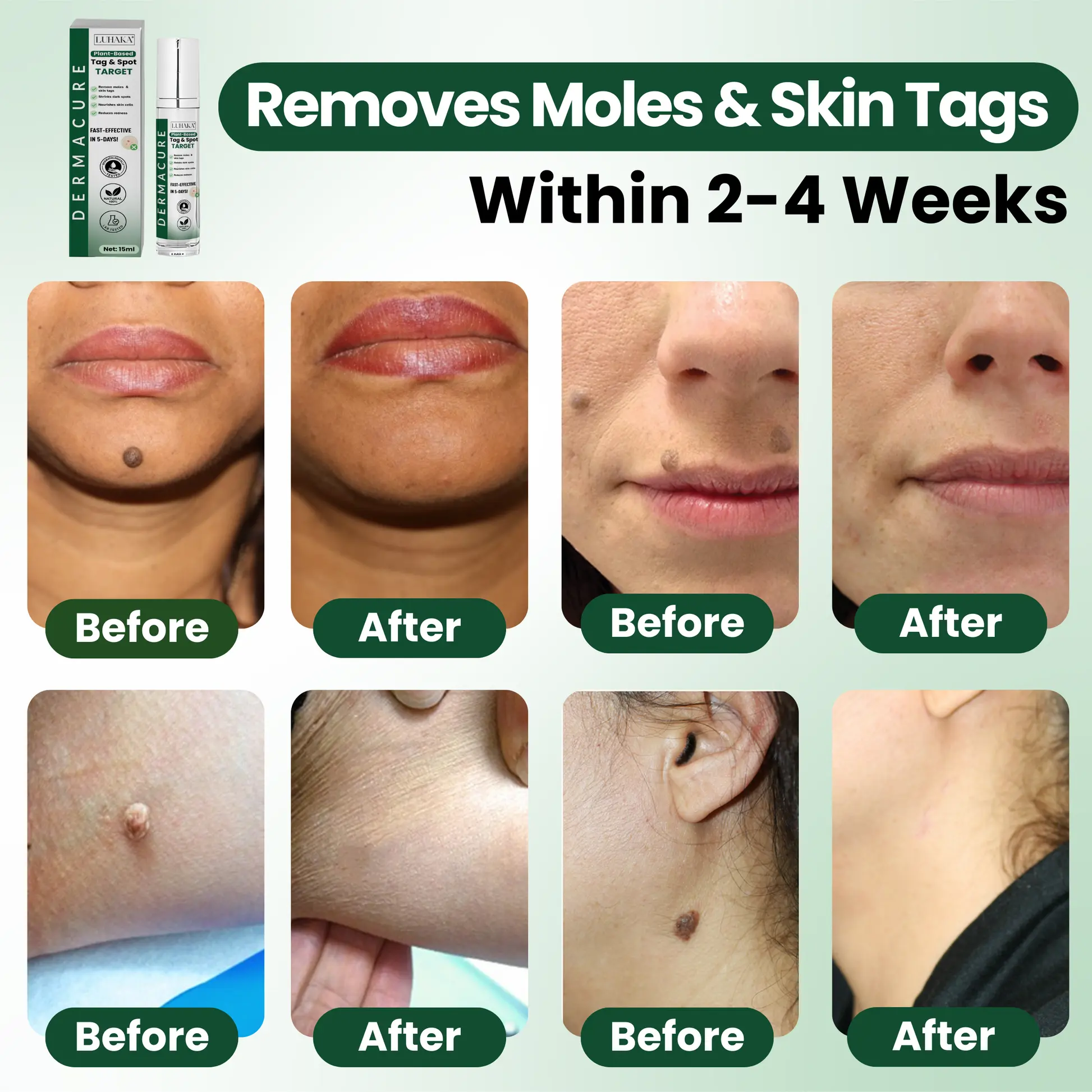 Luhaka® Reedle Shot 100 Tag Spot Target Advanced Serum ACE