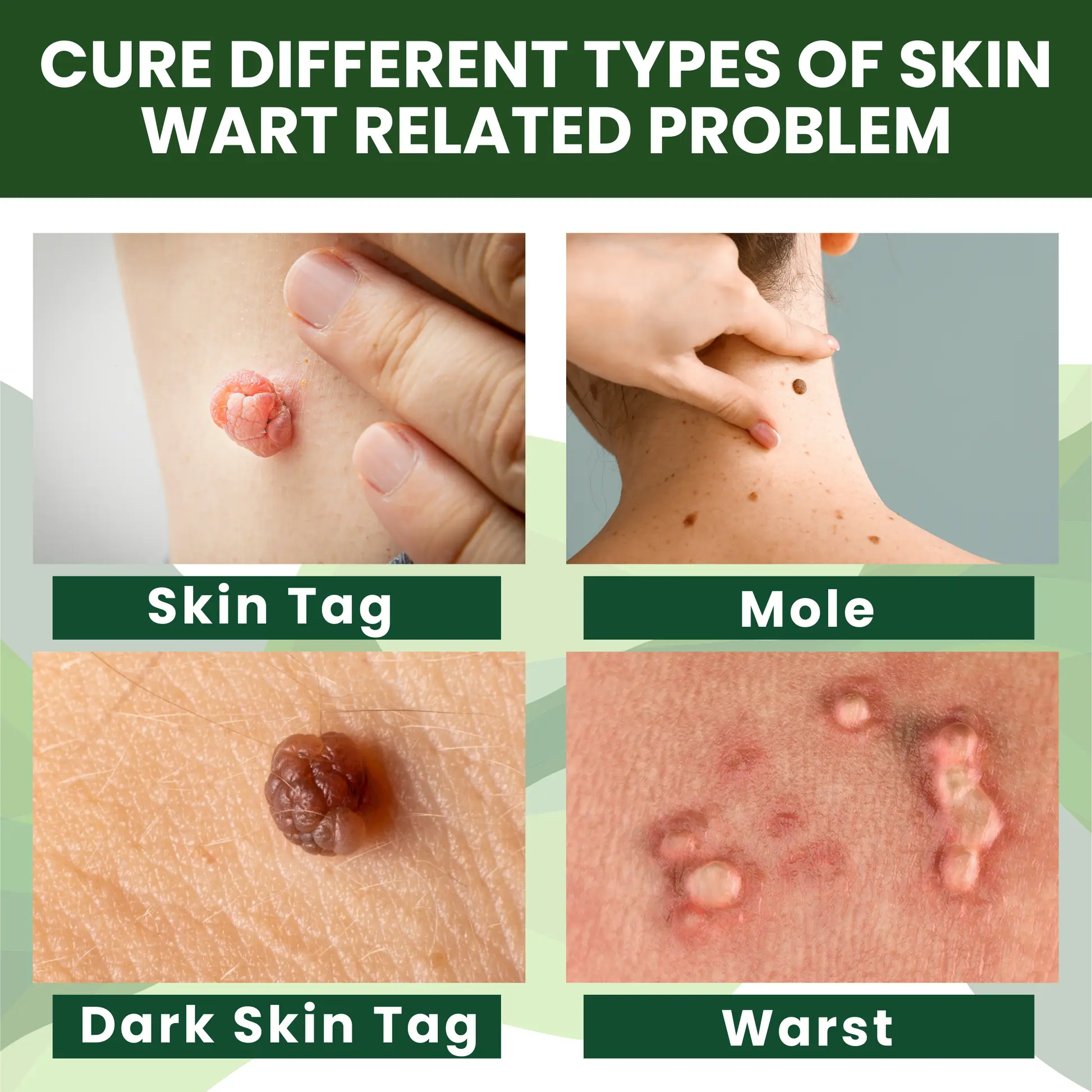 Luhaka® Reedle Shot 100 Tag Spot Target Advanced Serum ACE