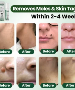 Luhaka® Reedle Shot 100 Tag Spot Target Advanced Serum ACE