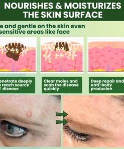 Luhaka® Reedle Shot 100 Tag Spot Target Advanced Serum ACE