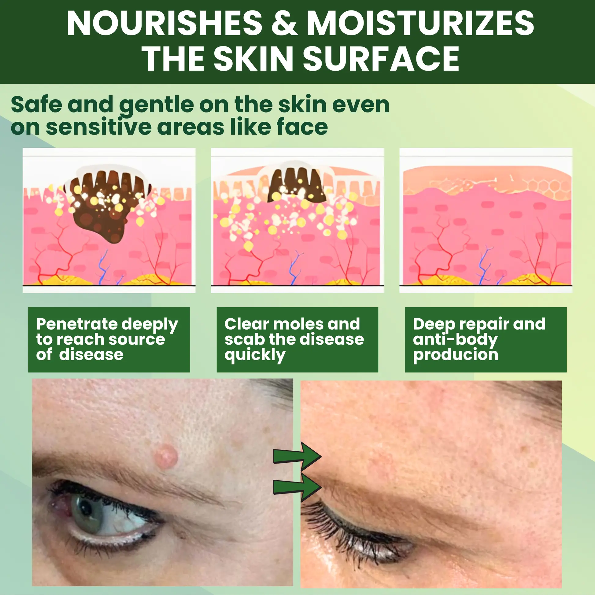 Luhaka® Reedle Shot 100 Tag Spot Target Advanced Serum ACE