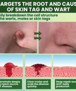 Luhaka® Reedle Shot 100 Tag Spot Target Advanced Serum ACE