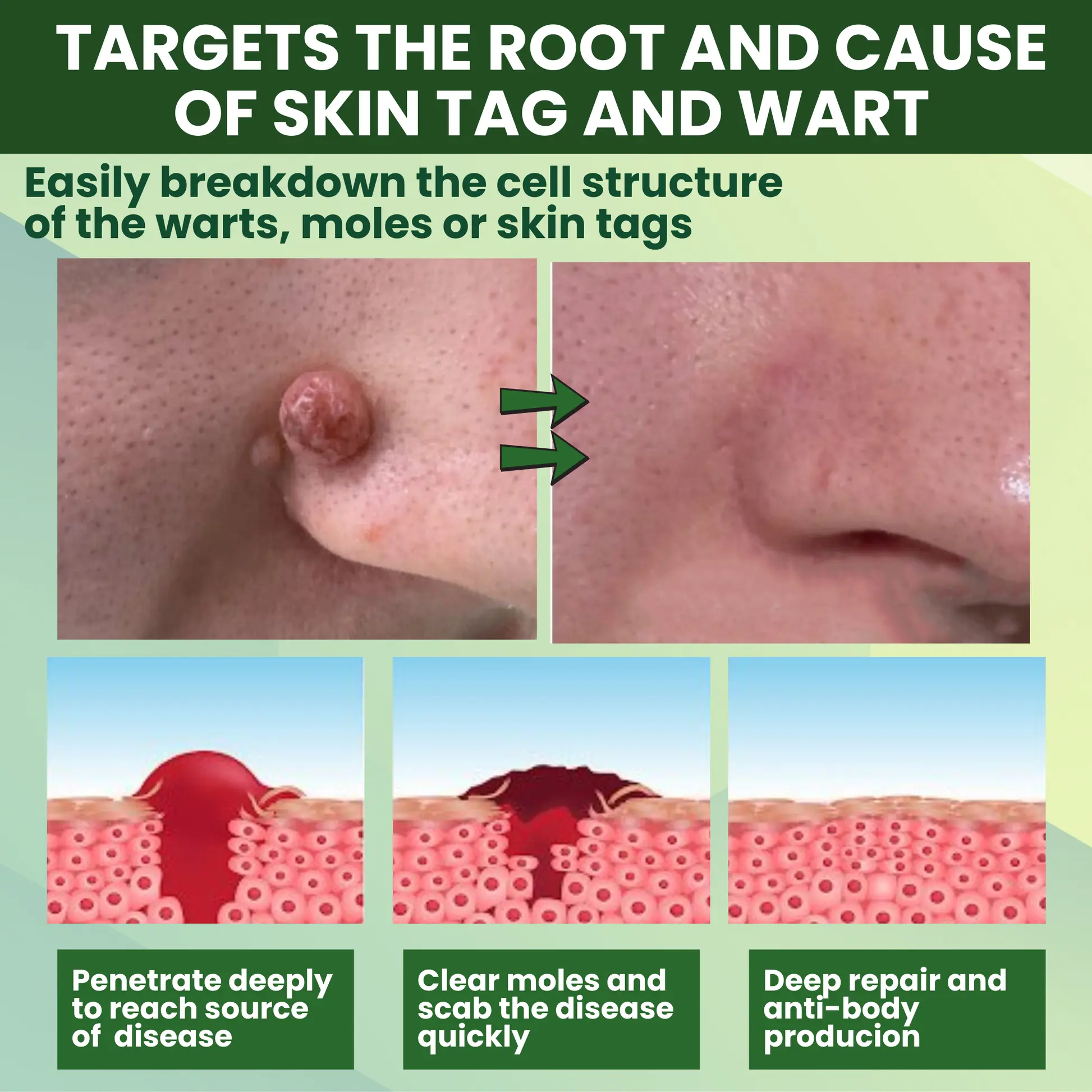 Luhaka® Reedle Shot 100 Tag Spot Target Advanced Serum ACE