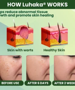 Luhaka® Reedle Shot 100 Tag Spot Target Advanced Serum ACE