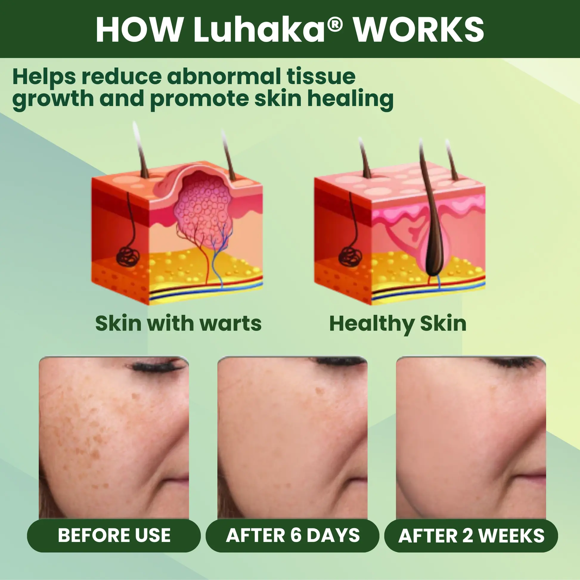 Luhaka® Reedle Shot 100 Tag Spot Target Advanced Serum ACE