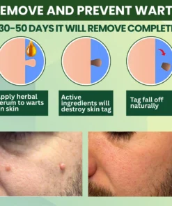 Luhaka® Reedle Shot 100 Tag Spot Target Advanced Serum ACE