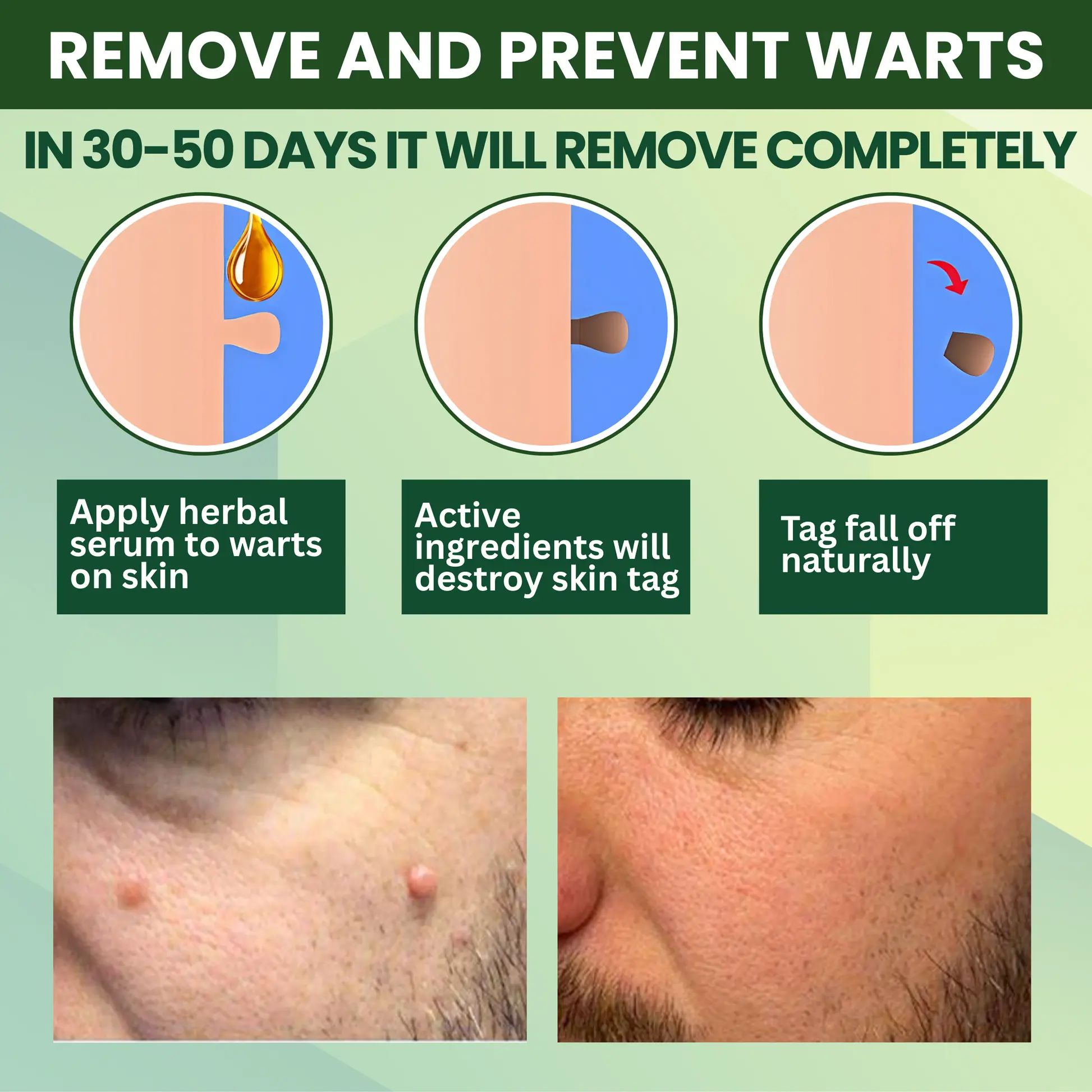 Luhaka® Reedle Shot 100 Tag Spot Target Advanced Serum ACE