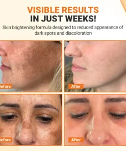 Luhaka® TripleAction Vitamin C Freckle Removal CreamUltra02