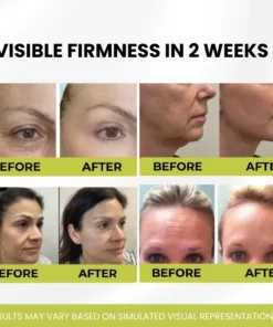 Luhaka® Turn Back 10 Years of Aging Without a Single Needle