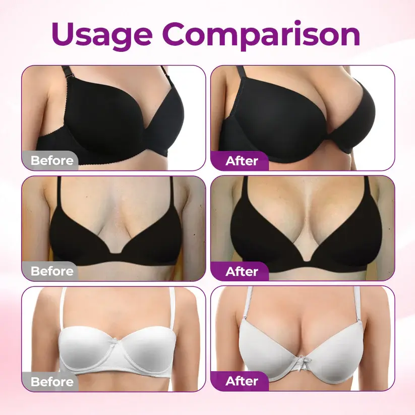 Luhaka® Targeted Breast Enhancement Advanced Nano Microneedle Patch